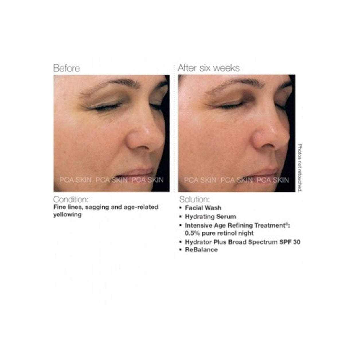 0.5% Pure Retinol Night Treatment A6784